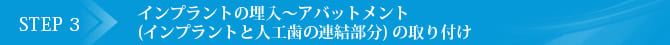 Step 3　インプラントの埋入～アバットメント（インプラントと人工歯の連結部分）の取り付け